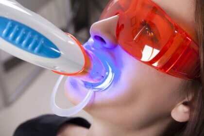Blue Light Teeth Whitening: Is It Safe, and Does It Work?